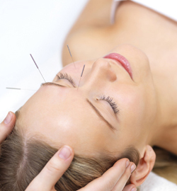 Cosmetic Acupuncture